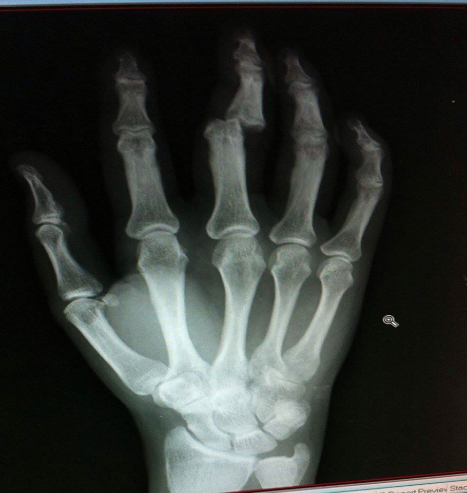 14556698_1161687857226335_4066504448429302037_o